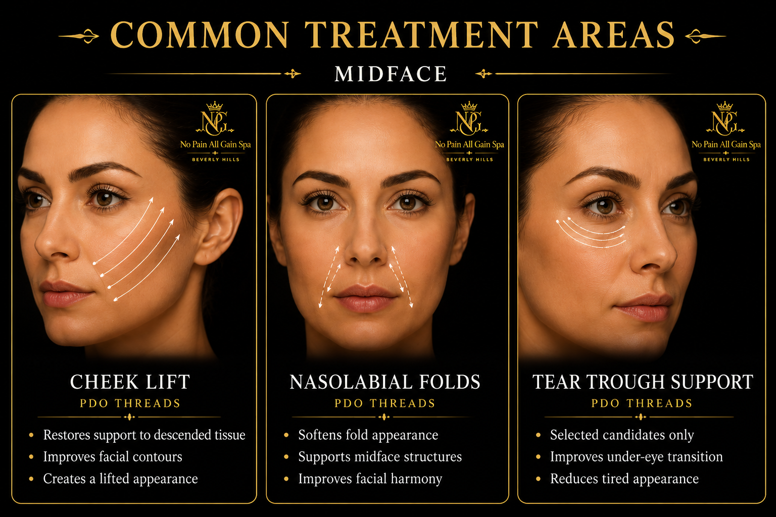 A promotional image displaying common facial treatment areas on women for a spa, with three sections titled 'Cheek Lift,' 'Nasolabial Folds,' and 'Tear Trough Support.' Each section shows diagrams of arrows indicating treatment zones, along with benefits listed below.