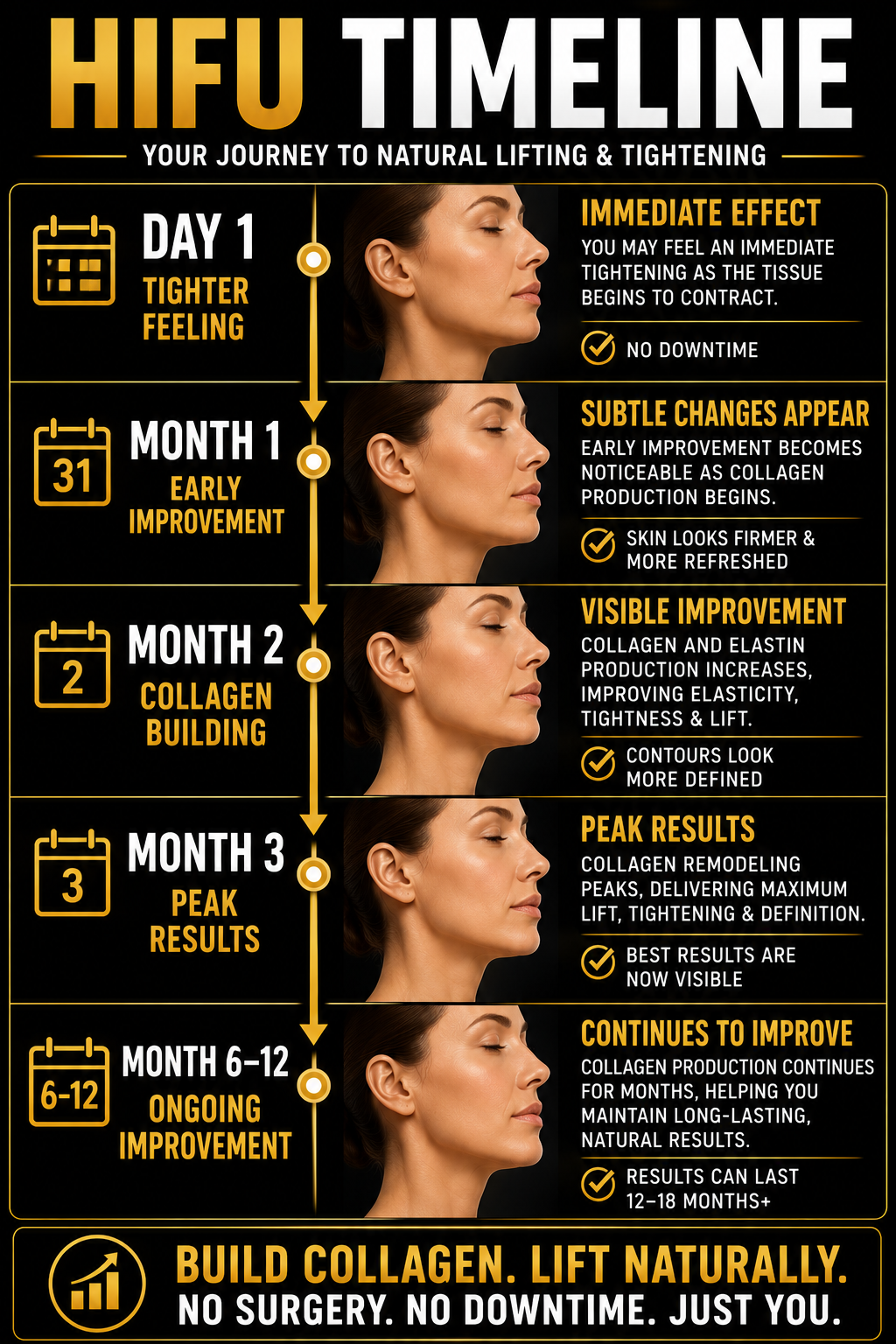 HIFU Timeline infographic detailing a natural lifting and tightening process over several months, starting with immediate tightening and progressing to collagen building, peak results, and ongoing improvement.