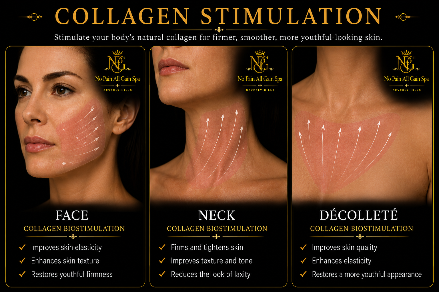Dermal filler treatment areas including face, neck and décolleté rejuvenation in Beverly Hills.