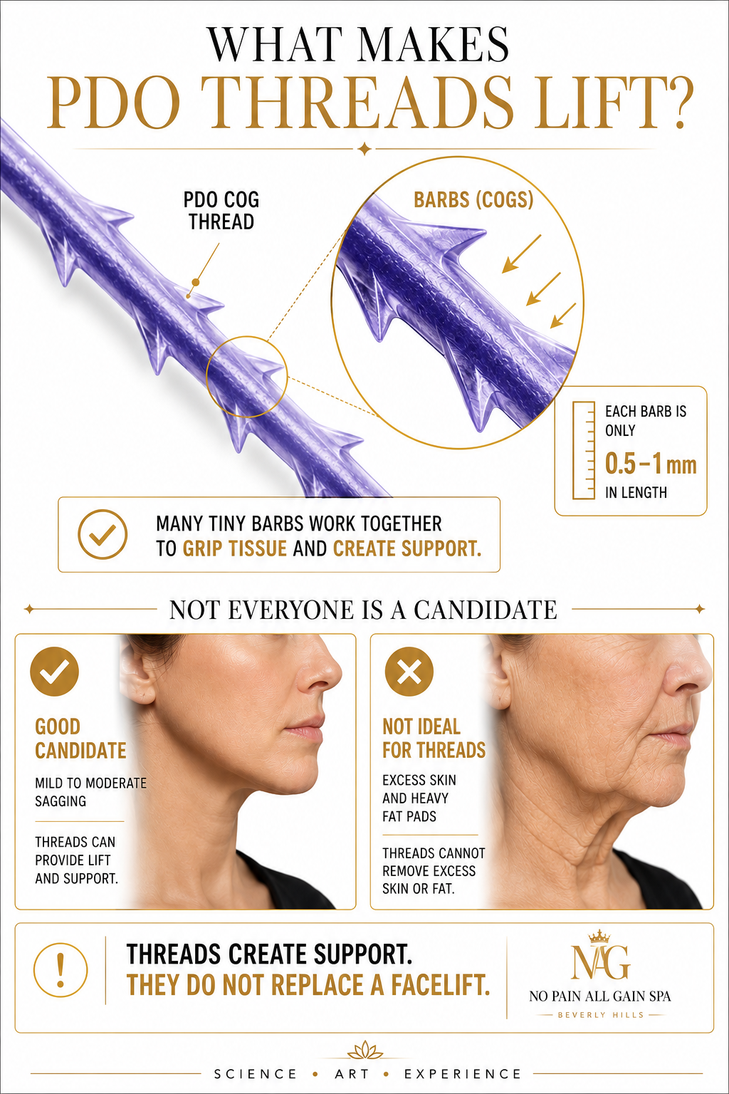 An infographic explaining what makes PDO threads lift skin, highlighting tiny barbs called cogs on the threads. It says many small barbs work together to grip tissue and create support, with each barb being 0.5 to 1 mm long. The infographic shows a side profile of a woman with a good candidacy for PDO threads, versus a woman with mature skin who is not a good candidate. It emphasizes that threads create support but do not replace a facelift.