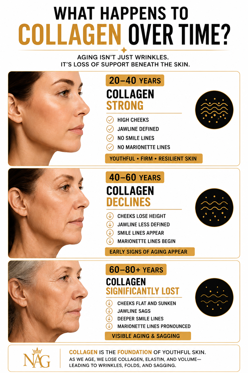 An infographic explaining the effects of collagen loss over different age ranges, with images of a woman's face at 20-40, 40-60, and 60-80+ years showing increasing signs of aging.