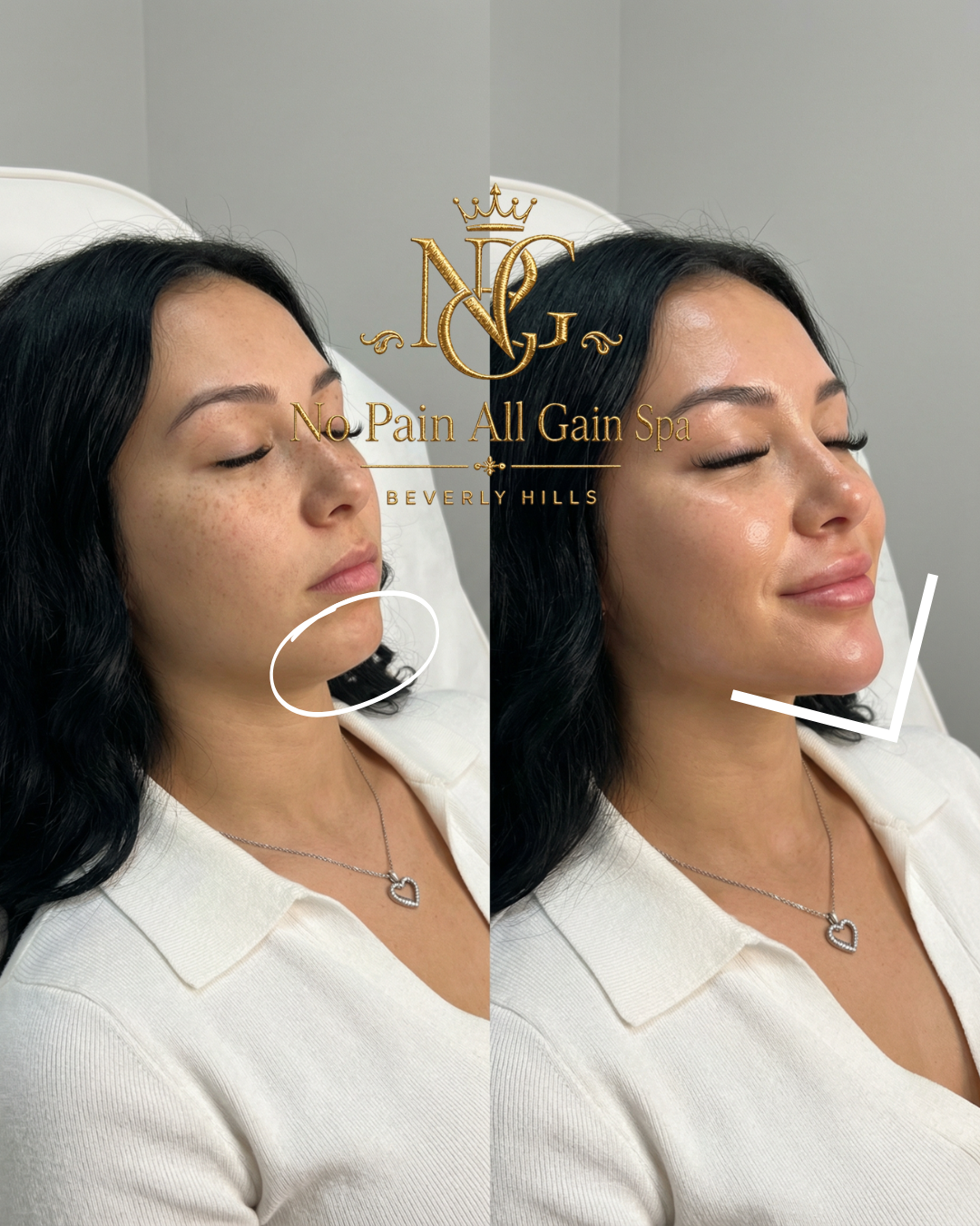 Side-by-side photos of a woman before and after a skincare treatment, with a logo and text overlay for 'No Pain All Gain Spa Beverly Hills.' The woman has dark hair, is wearing a white top and heart-shaped necklace, and is shown with her eyes closed 