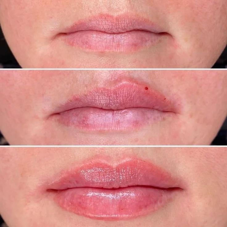 Close-up of human lips showing different states of hydration and healing, from dry to slightly swollen to moist and plump.