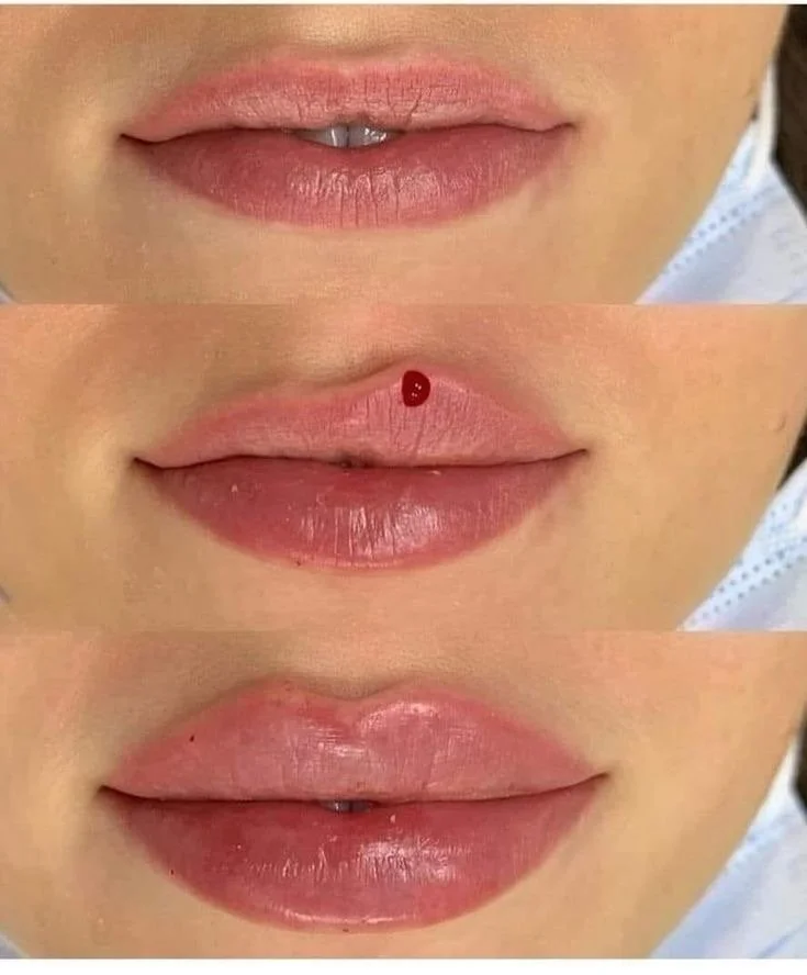Sequence of close-up images showing lips before, with a small red dot, and after applying gloss or balm.