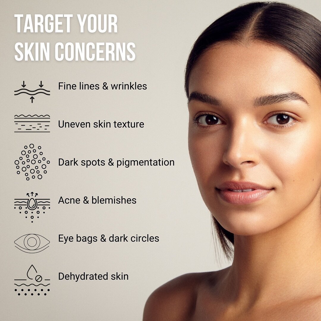 CACI is a customised non-surgical skin solution. It is  targeted and results driven. CACI can help improve skin health, no matter the concern. 

Whatever your skin goals, get in touch and we can discuss a tailor-made treatment plan. 
.
#caci #cacibea