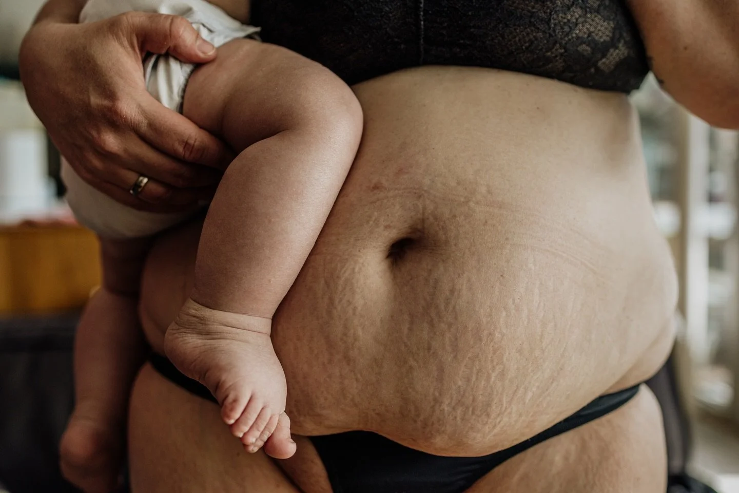So viele Monate, in denen ich diesen Bauch manchmal angeschaut habe wie etwas Fremdes.
Die Haut, die sich ver&auml;ndert hat. 
Die Streifen, die geblieben sind.
Und dann frage ich mich mit welchem Blick ich eigentlich gerade schaue? Ist es meiner? Od