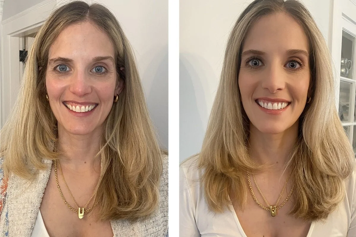 Sara bf & after final.jpg