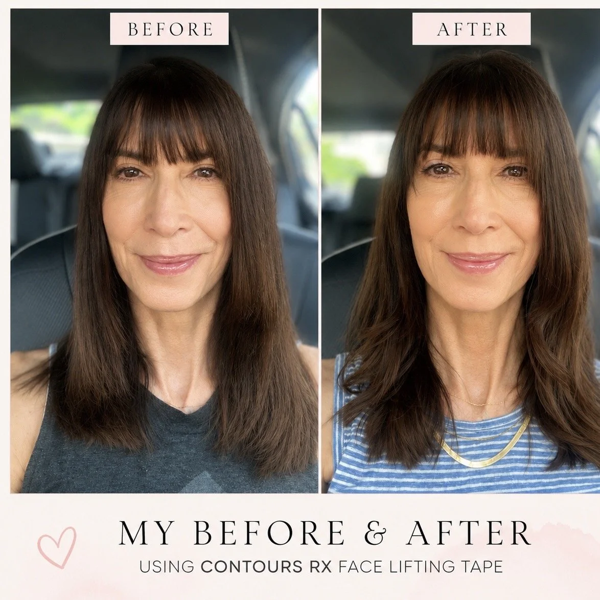 Face Taping: Does It Really Work? A Makeup Artist’s Honest Review