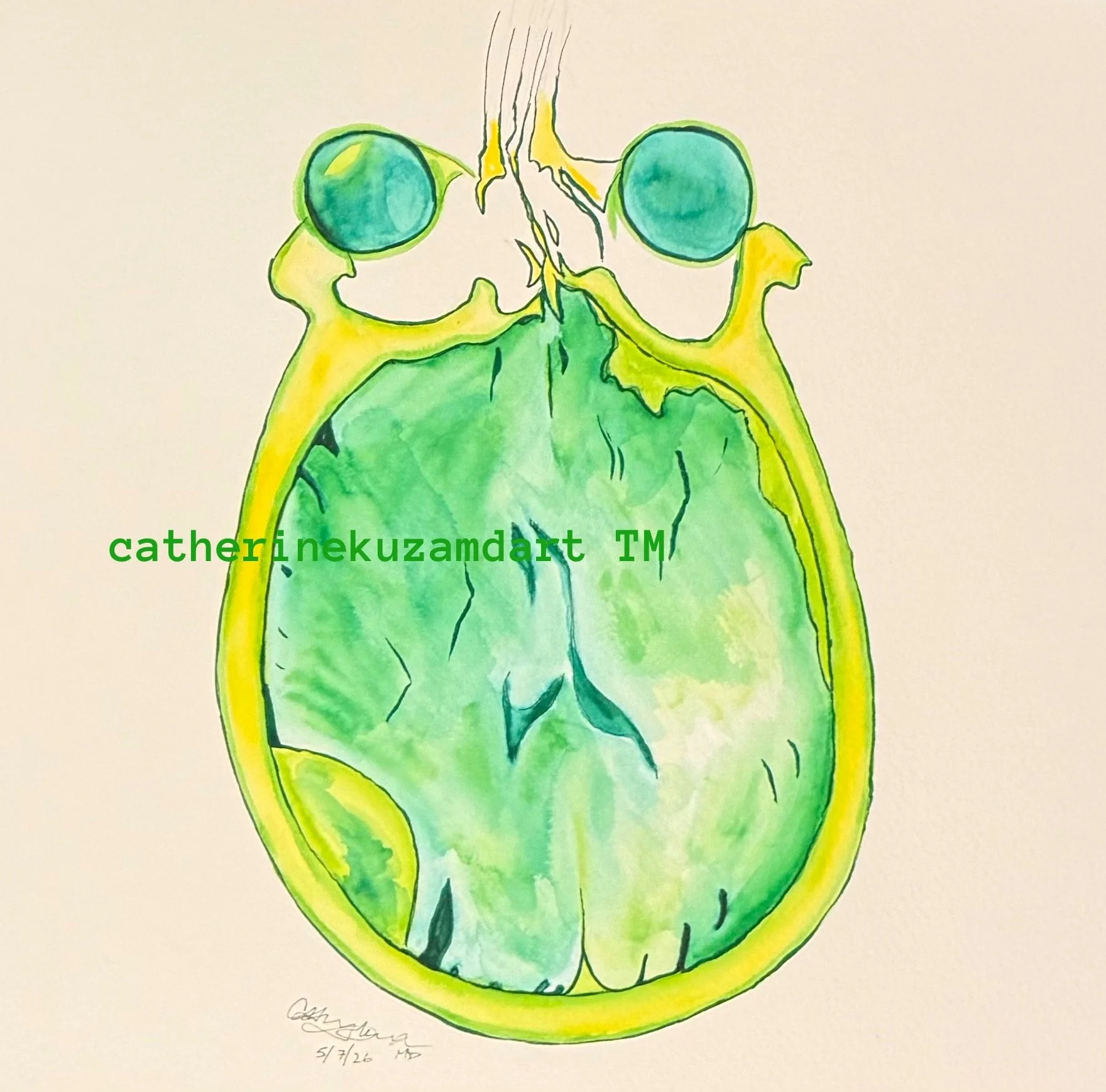 BRAIN CT GREEN CATHERINEKUZAMDART TM 10 9 26.JPG