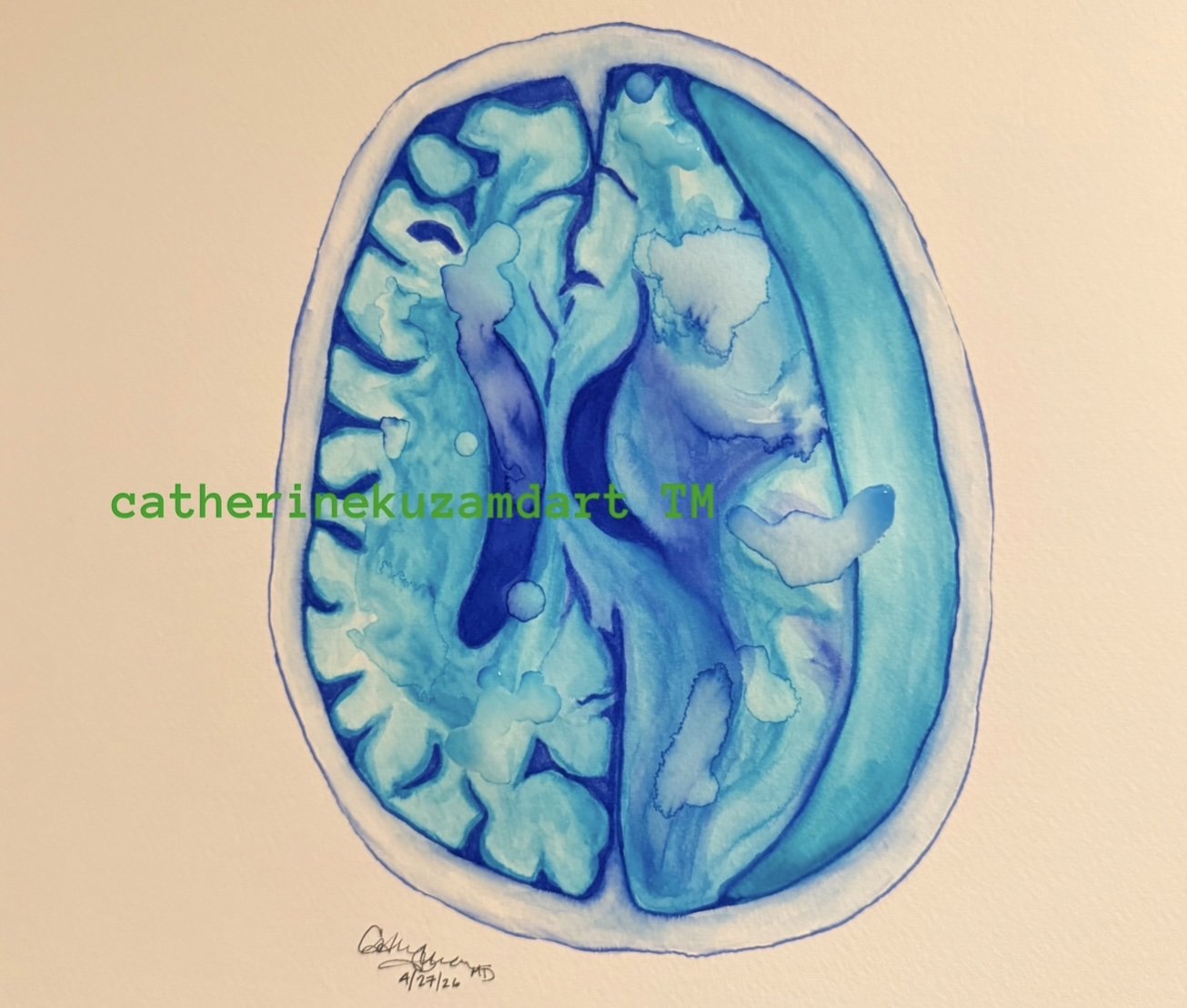 BRAIN CT CATHERINEKUZAMDART TM 10 9 2026.jpg