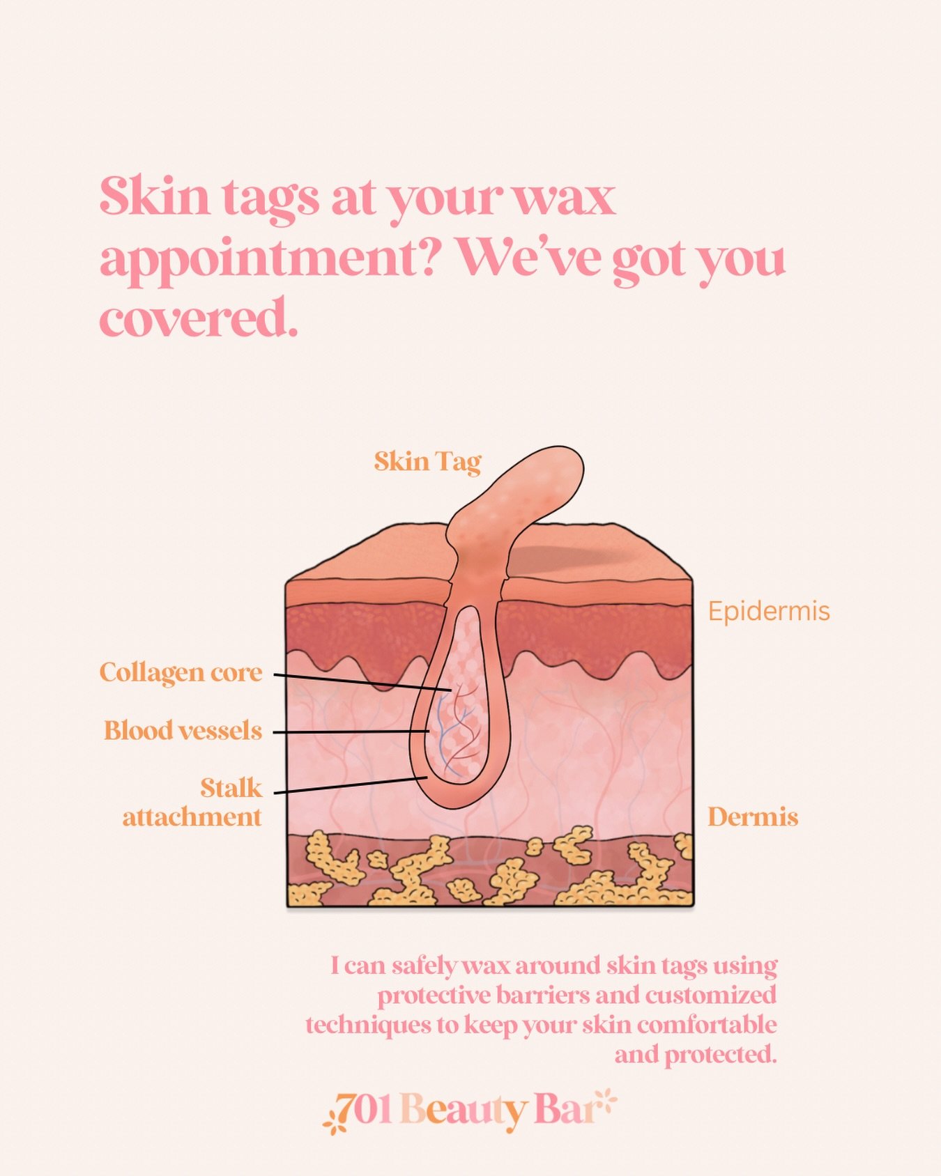 Skin tags are more than just &ldquo;extra skin.&rdquo;

They&rsquo;re made of normal skin layers, collagen fibers, tiny blood vessels, and sometimes nerve endings, which means waxing directly over them can cause bleeding, irritation, or injury.

Duri