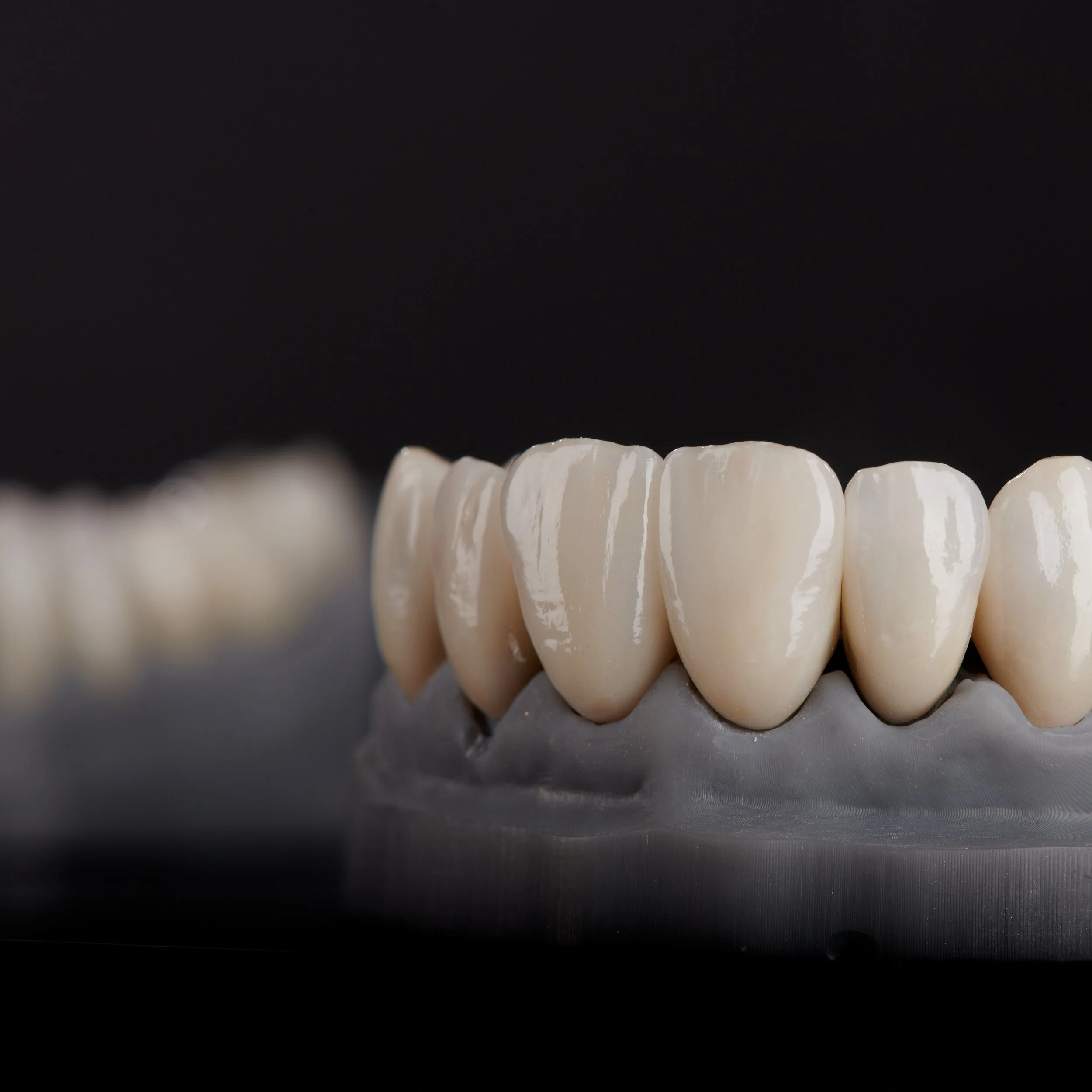 Crowns & Veneers