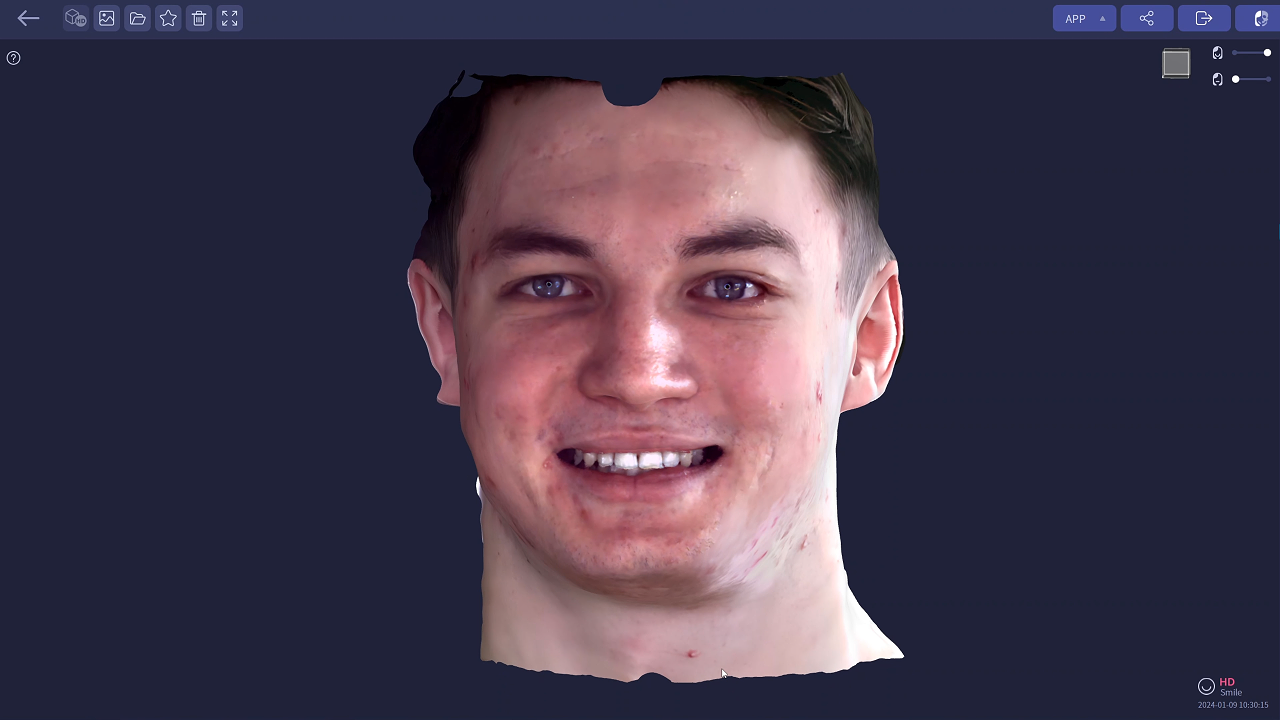 A Guide to 3D Face Scanning | dentesthetics
