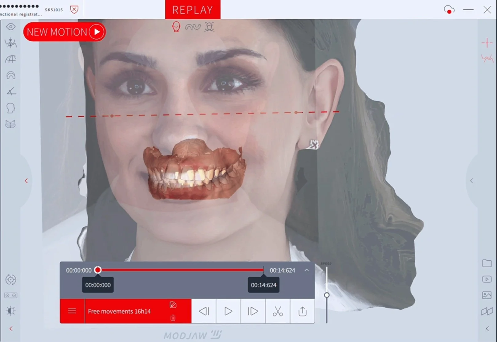 Modjaw and 4D Occlusion Course