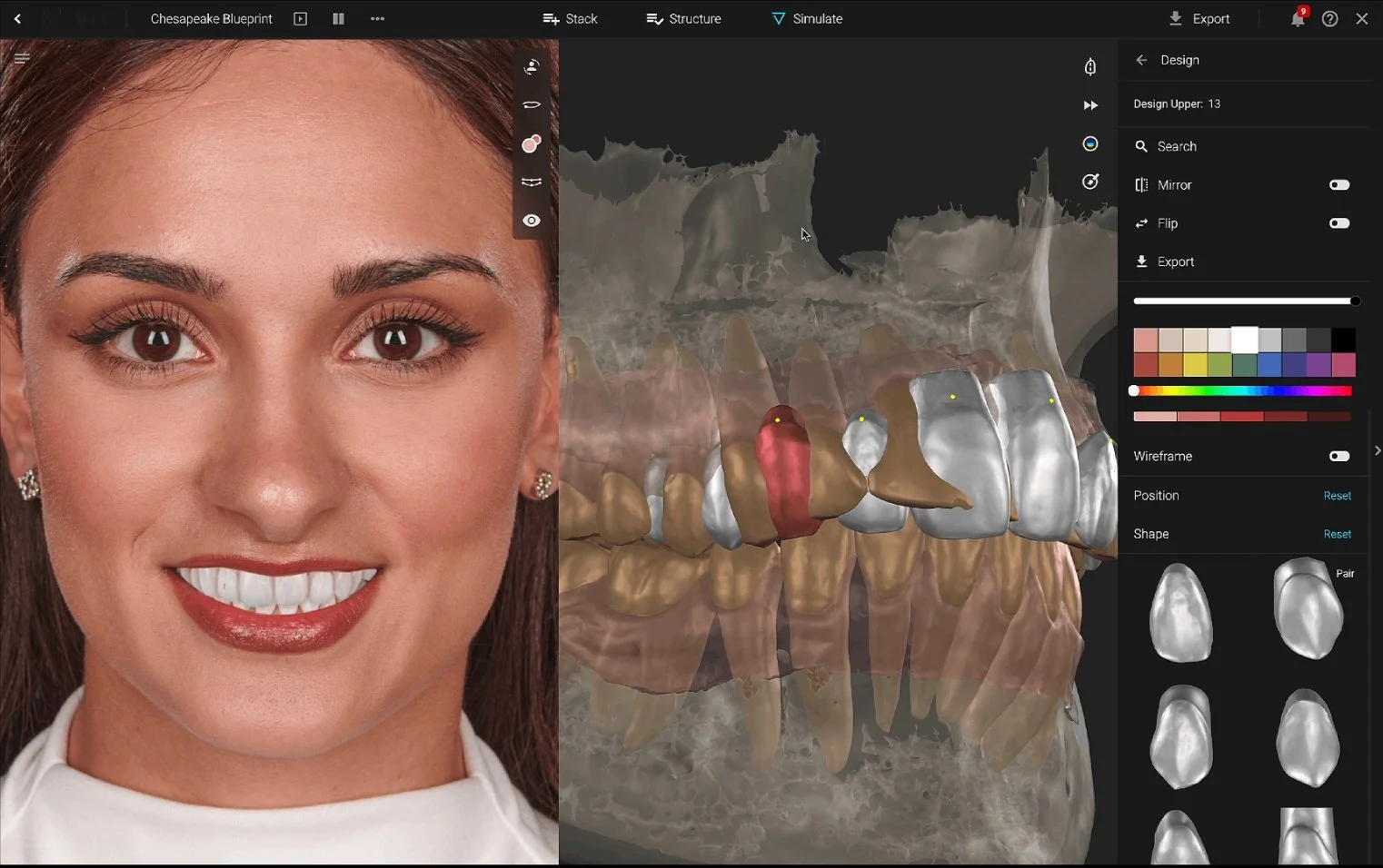 SmileCloud Digital Treatment Planning Course