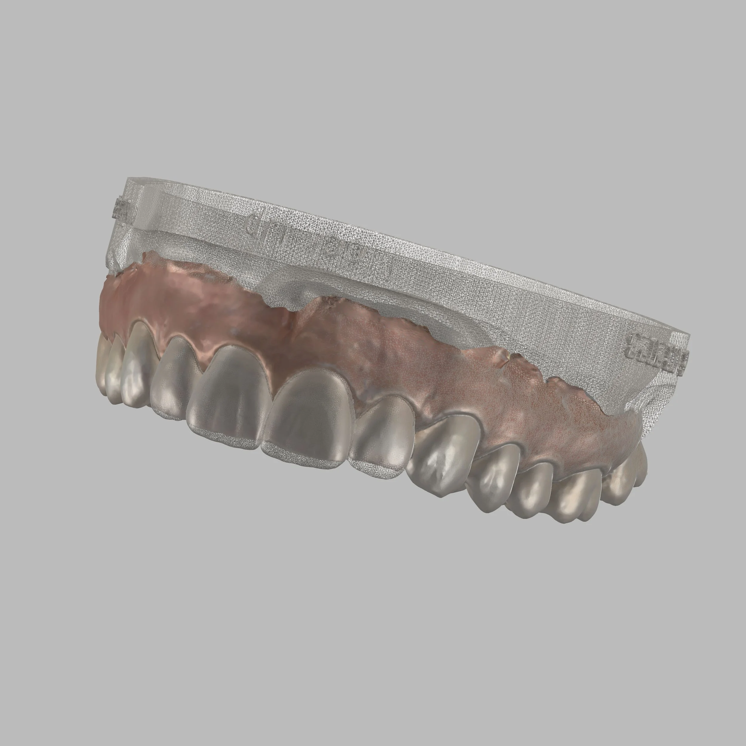 Dental MockUp Design