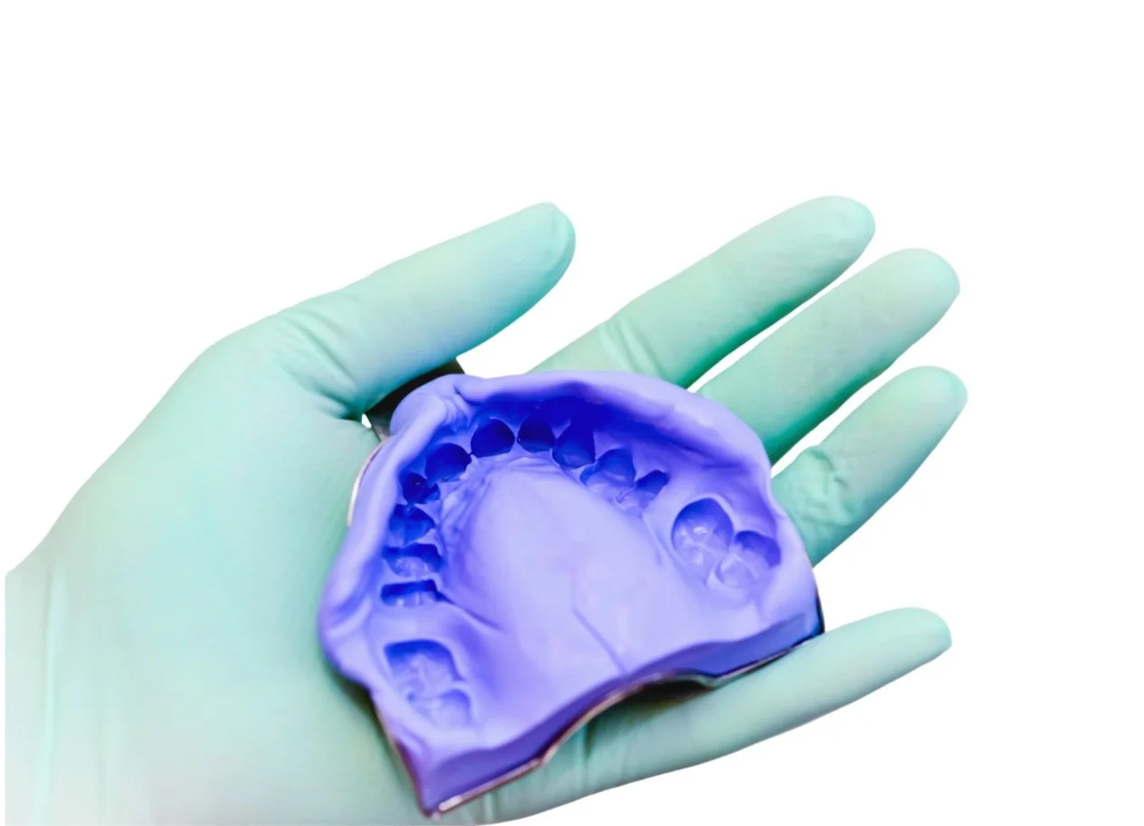 Say Goodbye to Gooey Impressions: Digital Scanners vs. Traditional ...