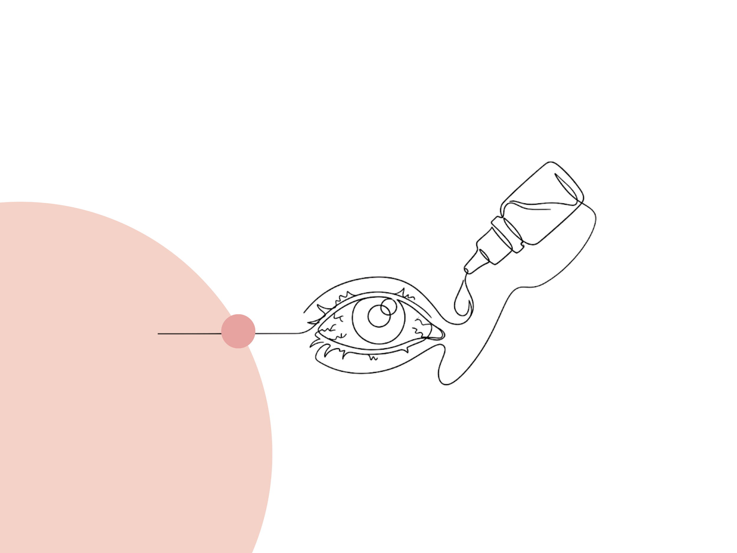 6 Tips for Managing Sjogren’s Syndrome Flares