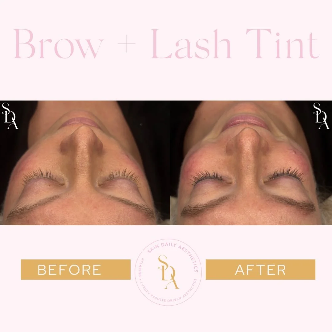𝗕𝗿𝗼𝘄𝘀 &amp; 𝗹𝗮𝘀𝗵𝗲𝘀, 𝗯𝘂𝘁 𝗯𝗲𝘁𝘁𝗲𝗿!✨ 

A tint that enhances&mdash;never overpowers&mdash;for the most natural look! 👀 

📍4136 Carroll Street NW Covington, GA 30014
📅 www.skindailyaesthetics.com
📞 470-721-9848
&bull;
&bull;
&bull;

