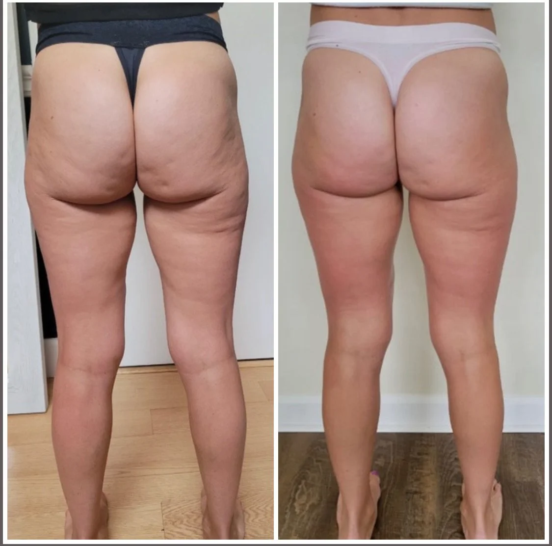 After 19 Treatments - Health & Beauty PT copy.JPEG