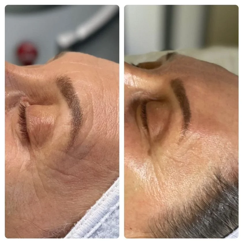 GIVE-CREDIT-The-Better-Skin-Spa-@thebetterskinspa-1-treatment-1.jpg