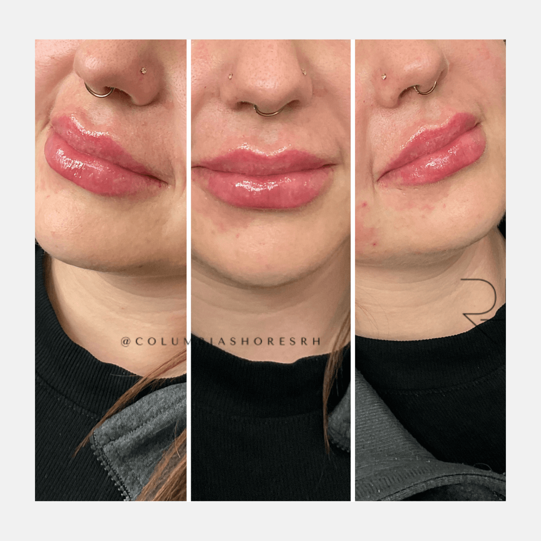 9 Lips.png