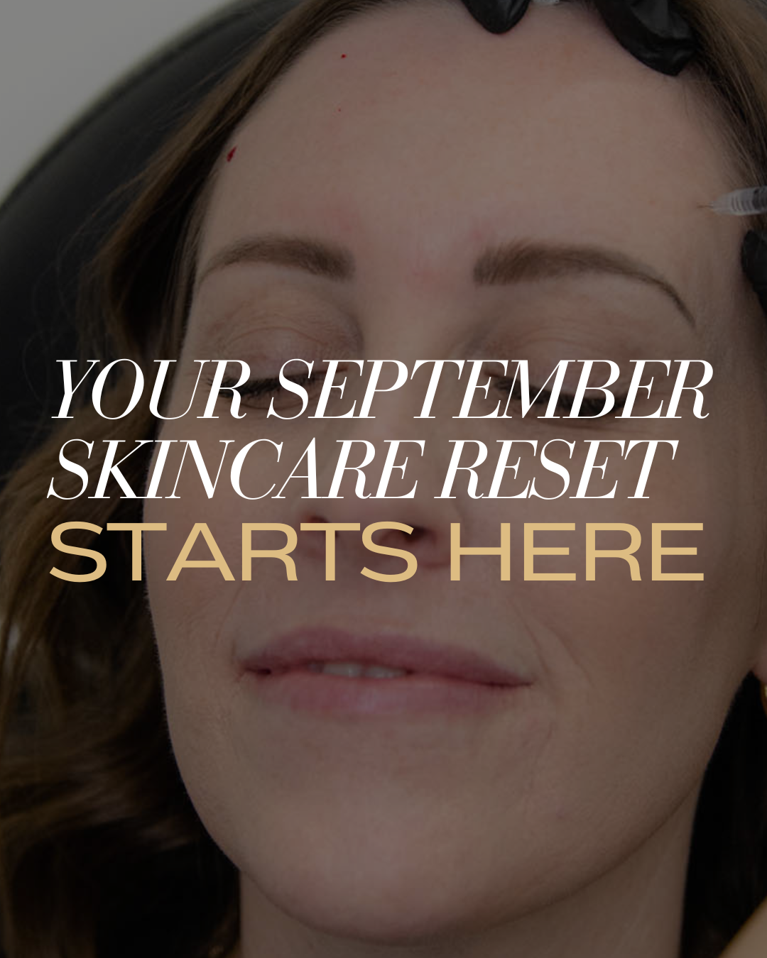 September Skincare & Confidence Specials at Columbia Shores Regenerative Health