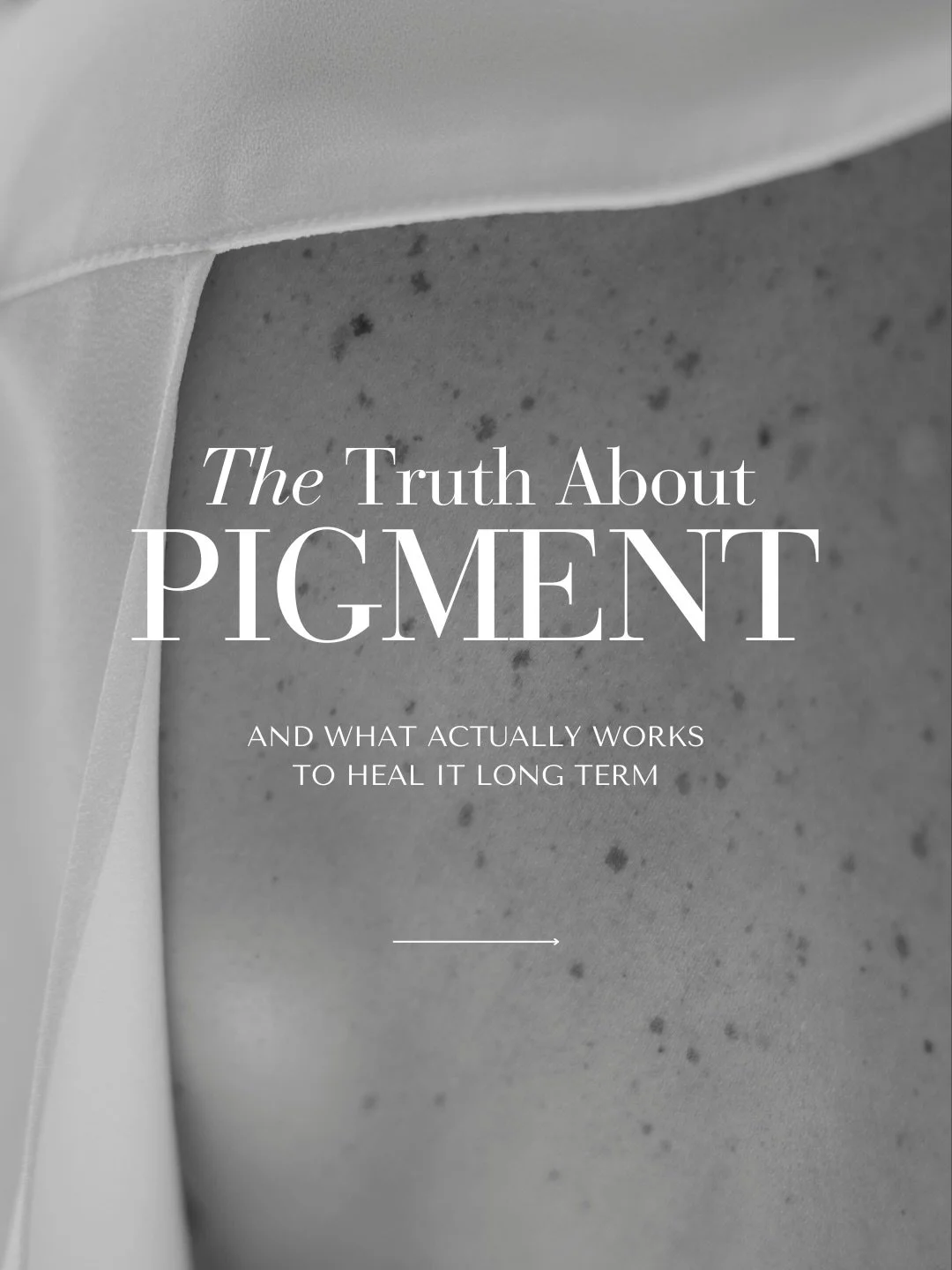 Let&rsquo;s clear something up &mdash; pigment isn&rsquo;t stubborn&hellip; it&rsquo;s misunderstood.

Melasma, sun damage, and post-inflammatory pigment don&rsquo;t all live in the same layer of skin, and they&rsquo;re not triggered the same way. Wh