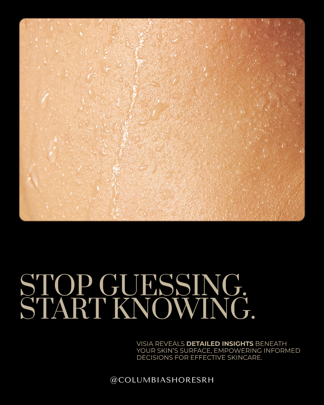 Advanced Skin Analysis with VISIA