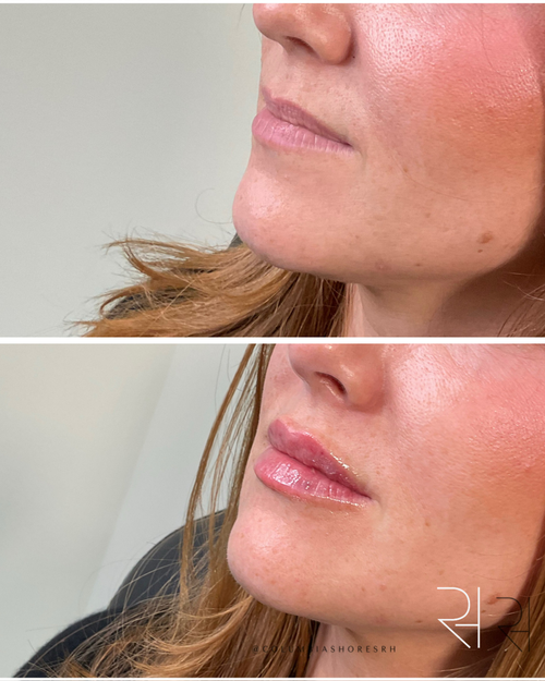 6 BA Lips (4).png