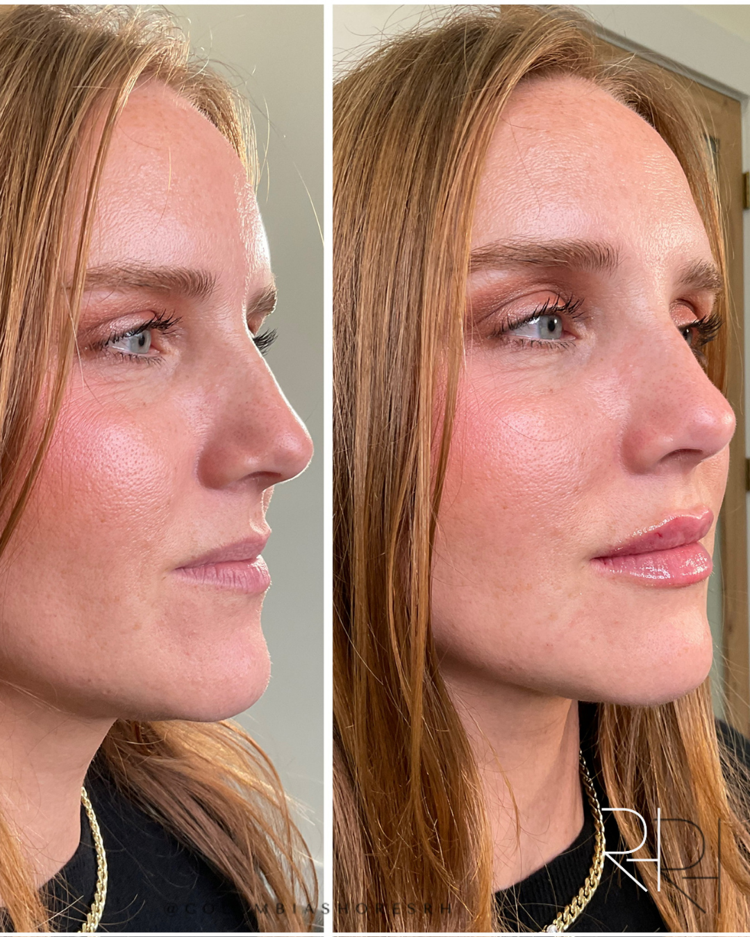 6 BA Lips (5).png