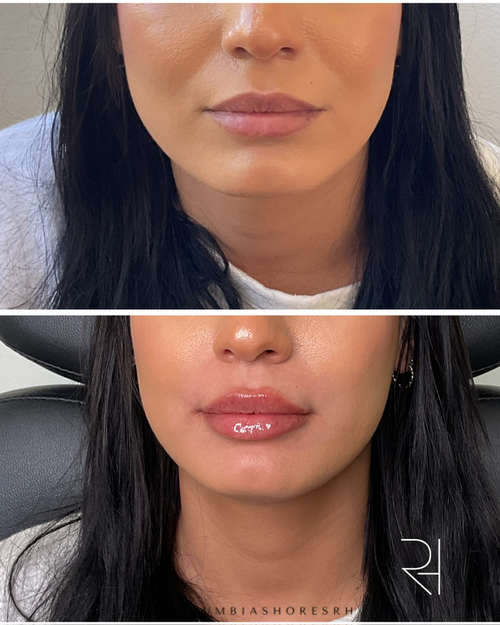6 BA Lips.png
