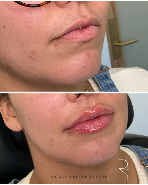 6 BA Lips (2).png