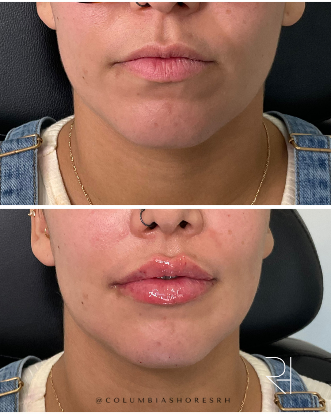 6 BA Lips.png