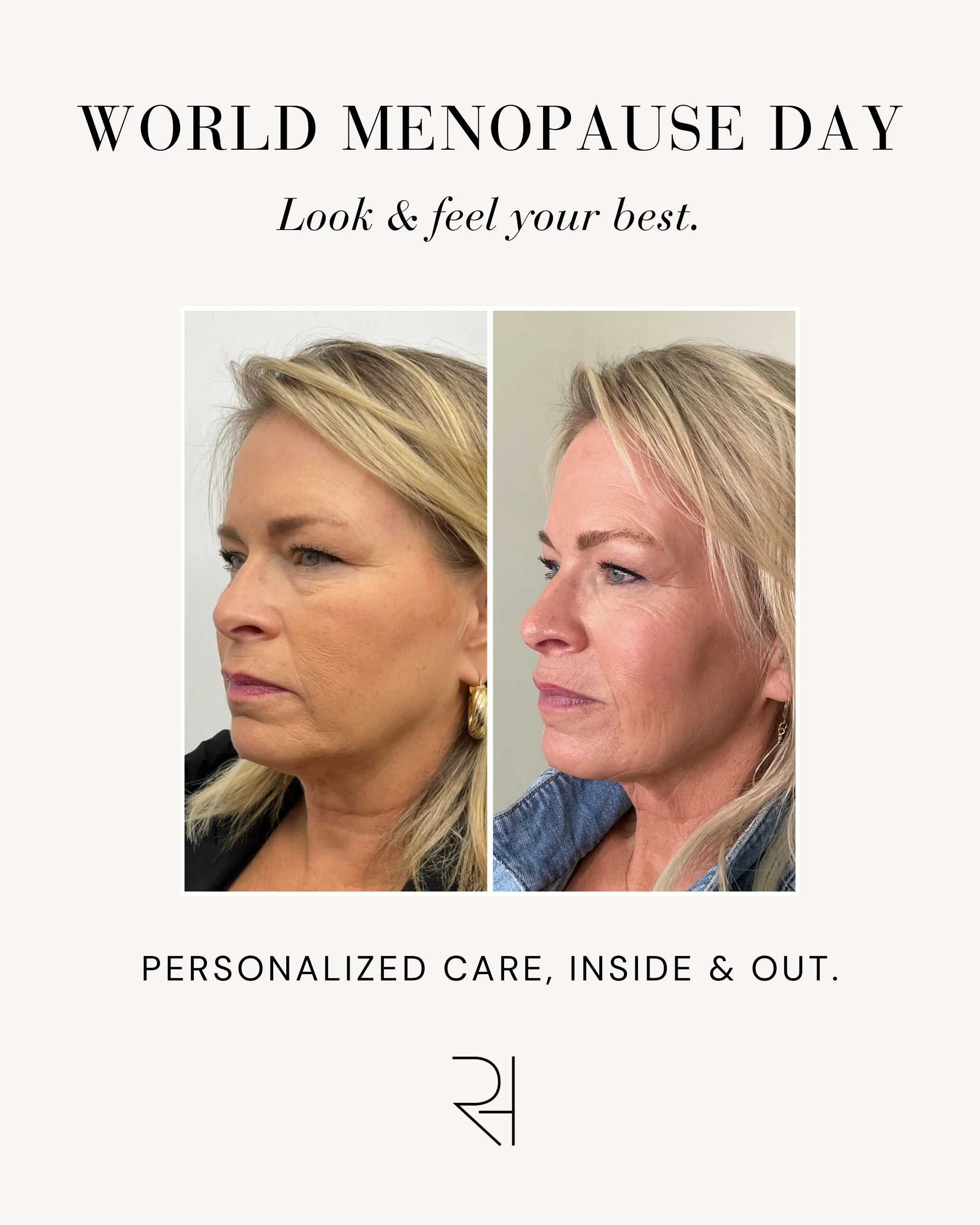 Feeling like yourself looks good on you. 💗

This World Menopause Day, we&rsquo;re talking about more than the glow on the outside. 

We&rsquo;re talking about feeling supported through the changes happening within.

Menopause can bring changes to yo