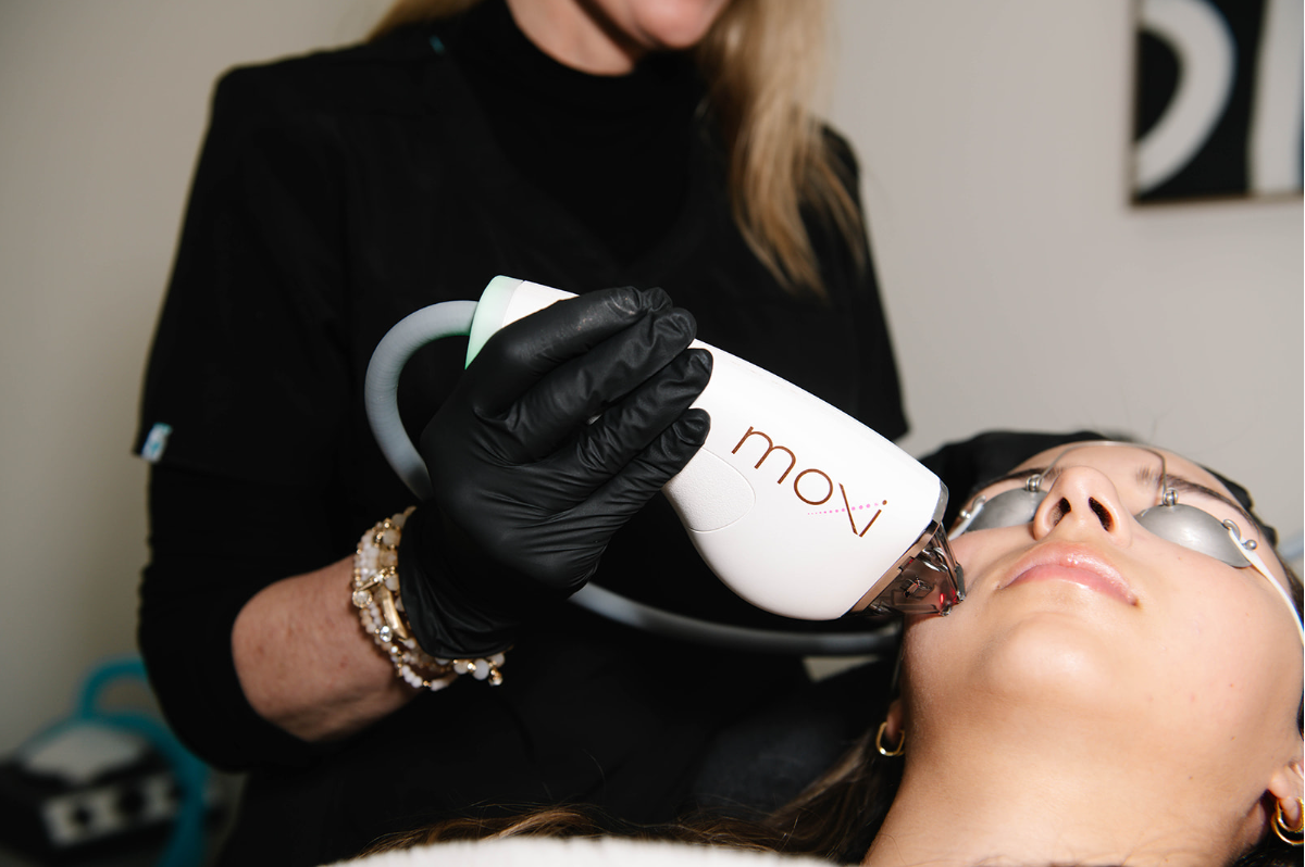 Sciton Moxi Laser treatment for youthful skin at Columbia Shores Regenerative Health