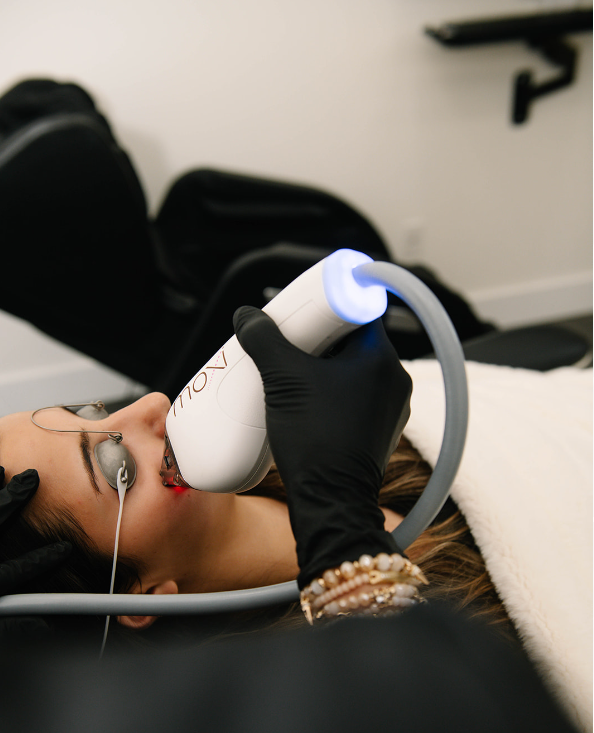 Patient receiving Sciton Moxi Laser facial treatment at Columbia Shores Regenerative Health for radiant skin