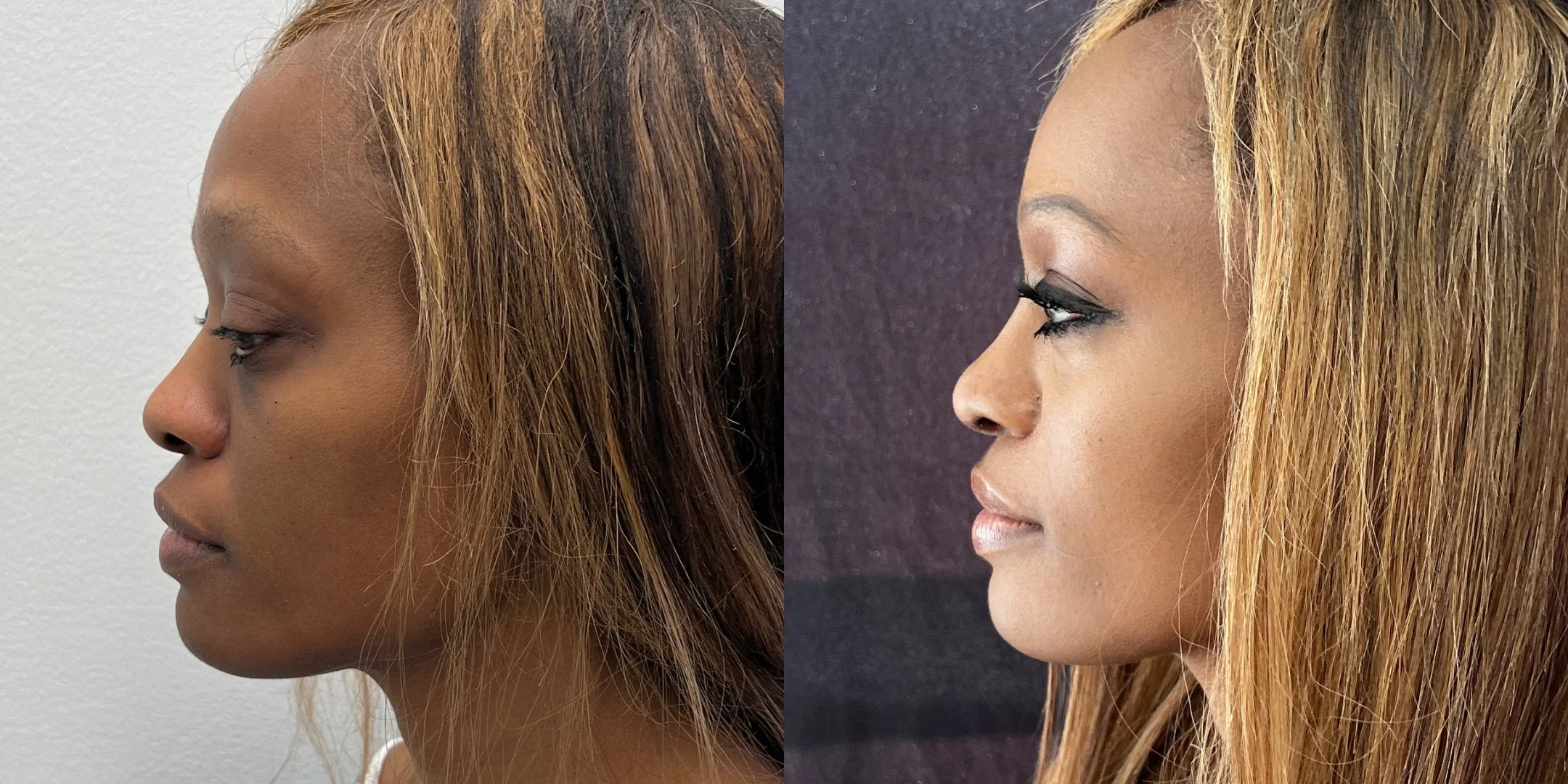dr-michael-omidi-before-and-after-photo-of-client.jpg