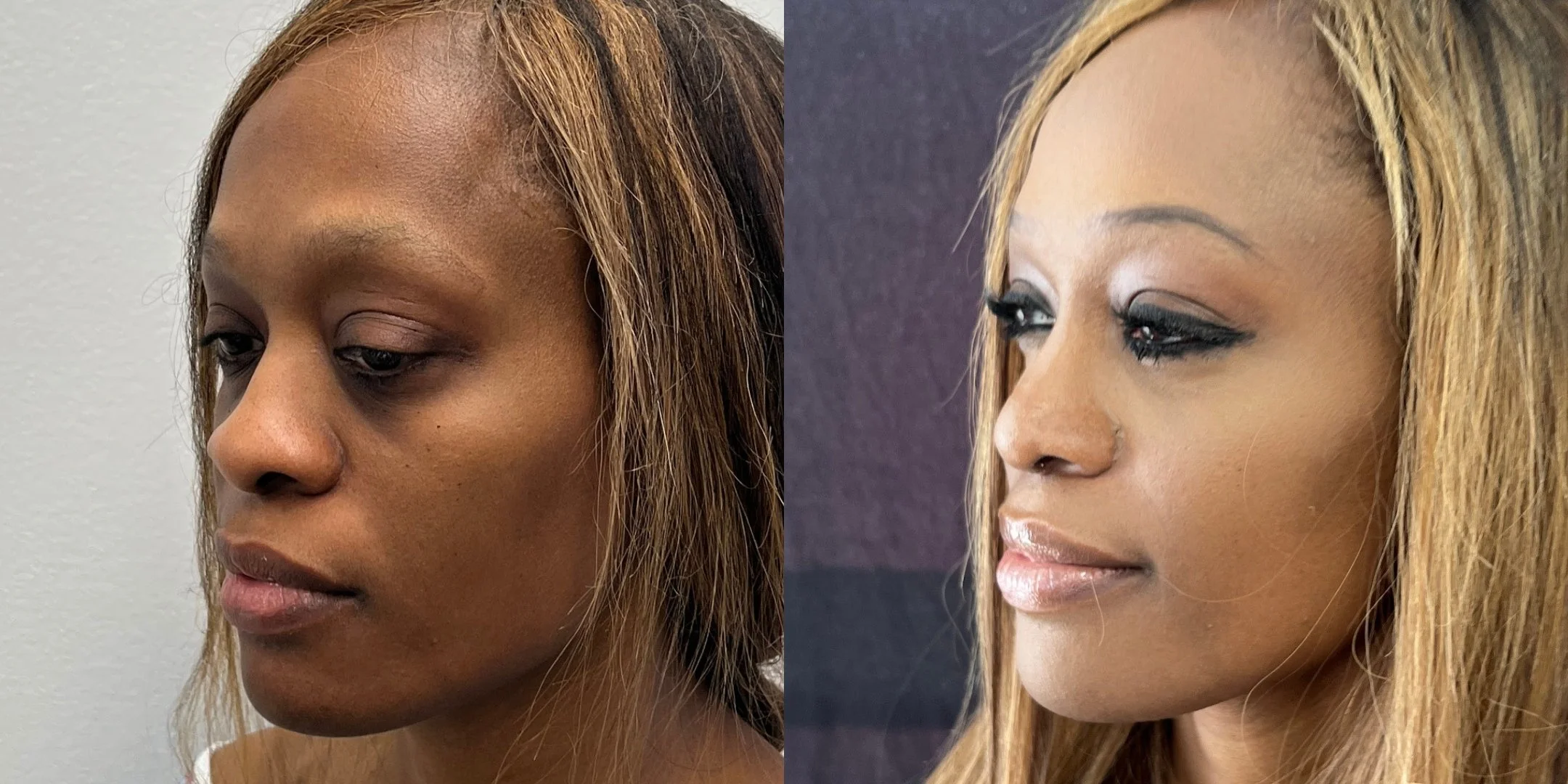 dr-michael-omidi-before-and-after-photo-of-client (2).jpg