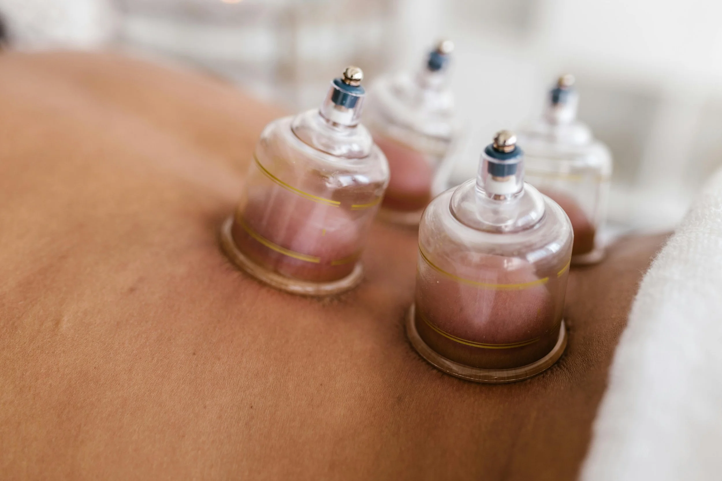 cupping cups on a bare back during a massage