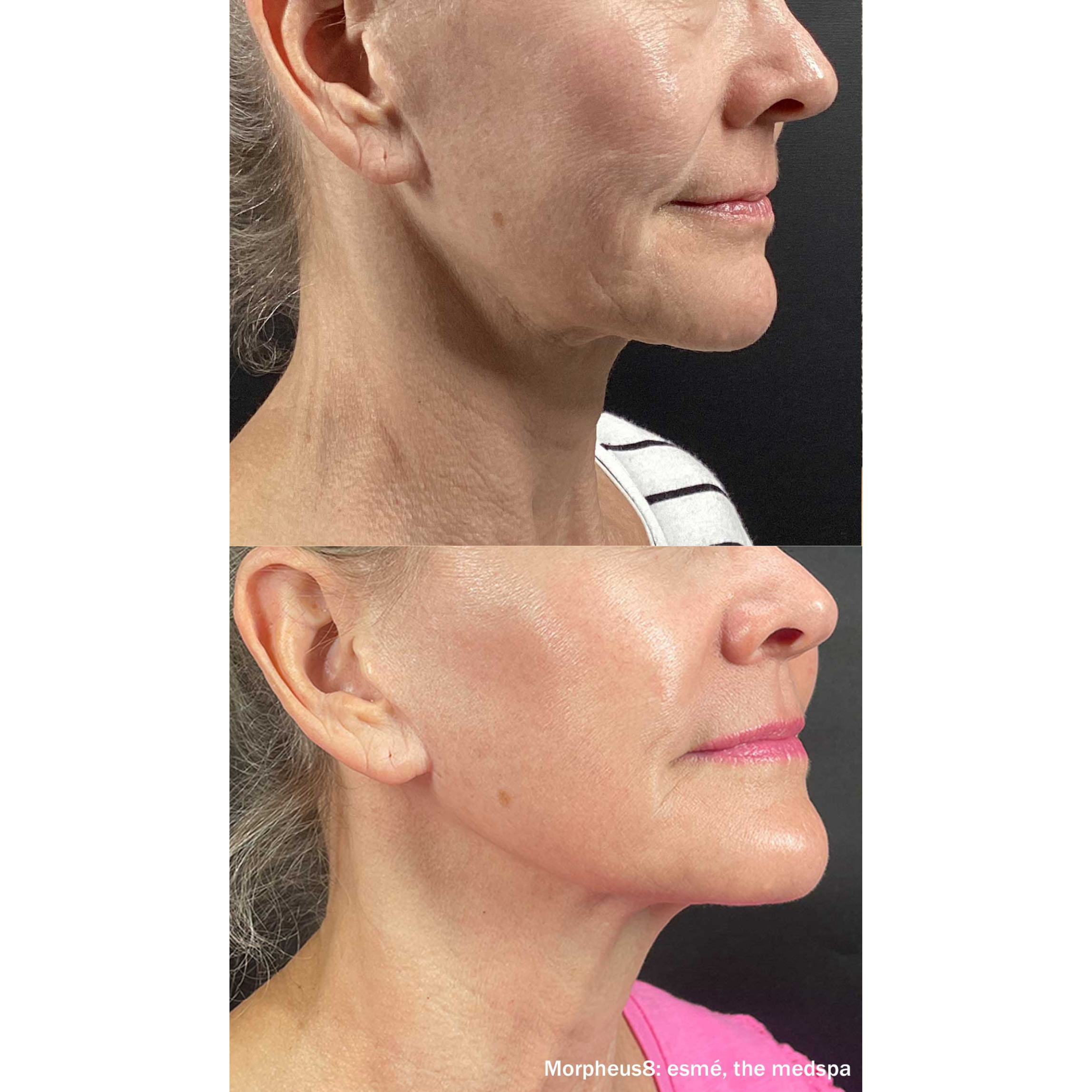 A healthcare professional in gloves using a black dermatoscope to examine a patient's facial skin.