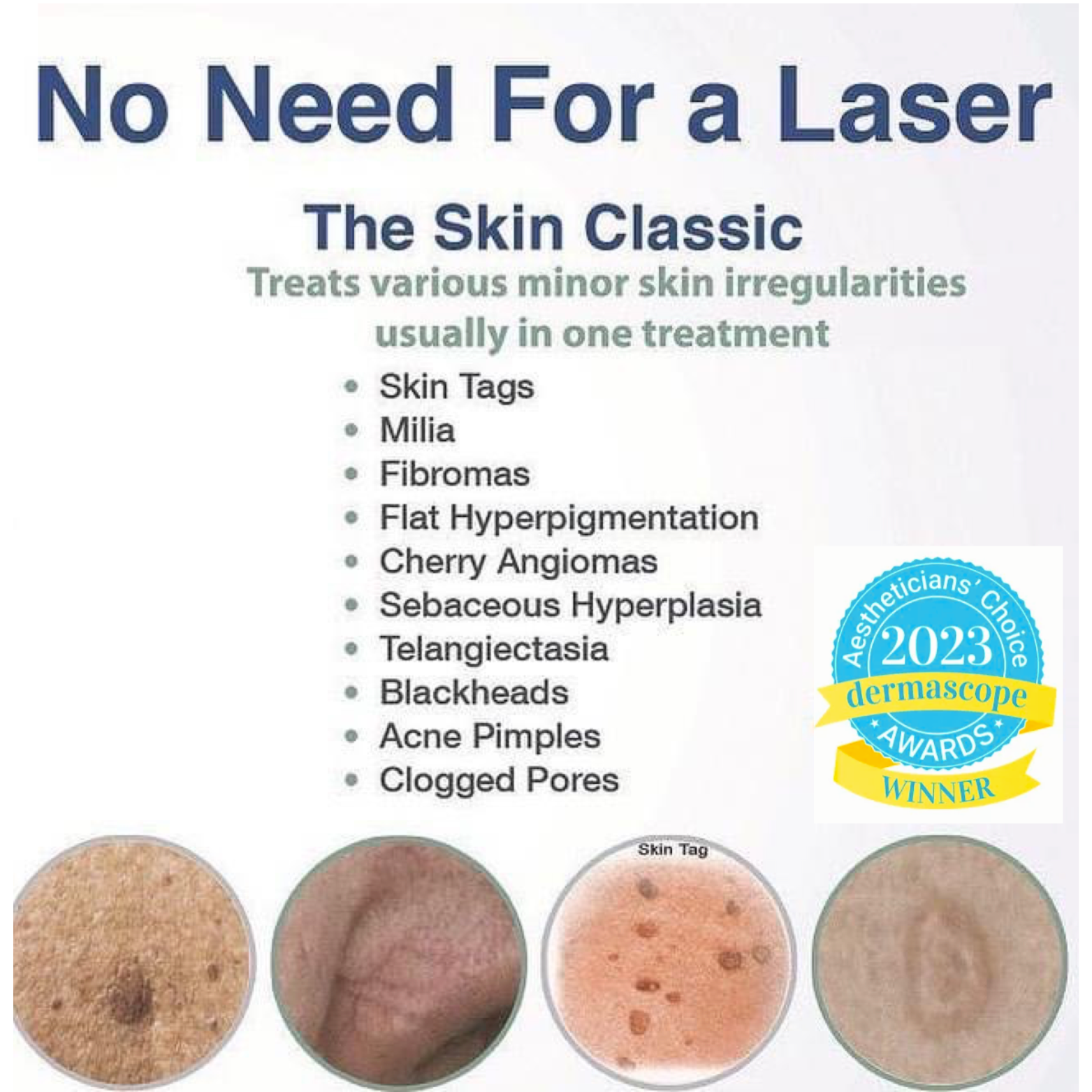 Skin Classic – Treat Skin Tags, Redness, & Blemishes | DE — Phases ...