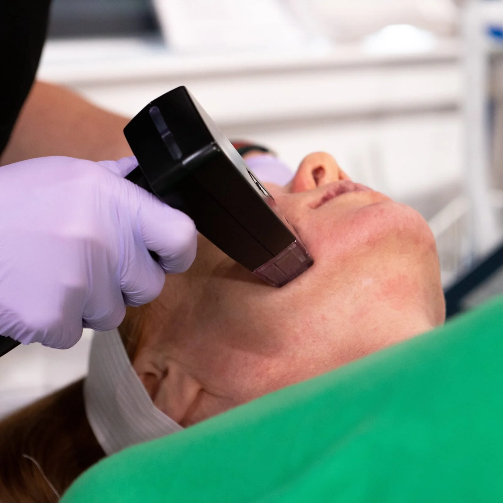 A healthcare professional in gloves using a black dermatoscope to examine a patient's facial skin.