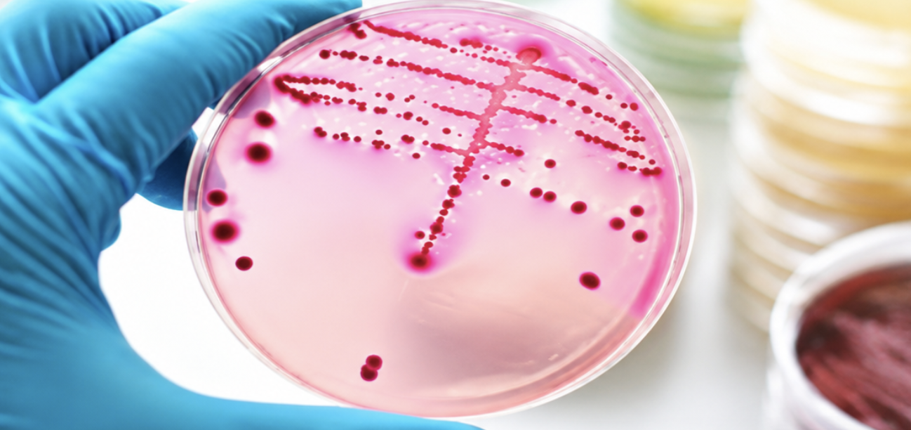 Bridging the Gap: The Under Representation and Gender Gap in Microbiology