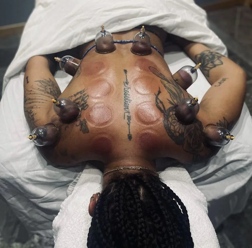 Massage + Cupping Therapy