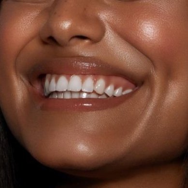 Teeth Whitening Session