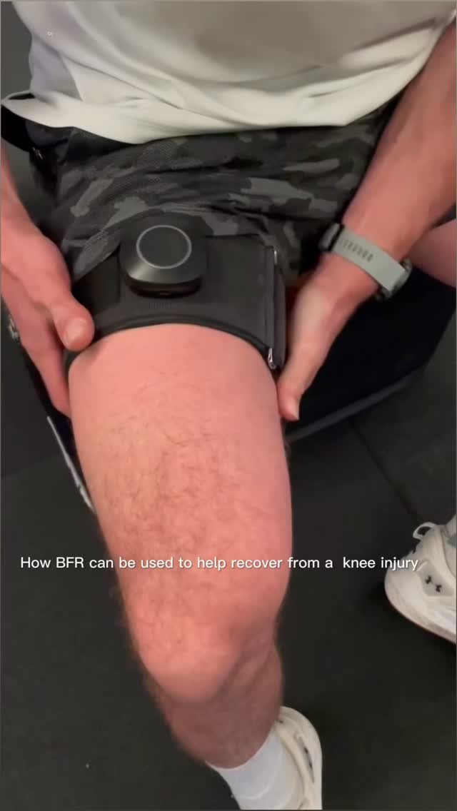 Rebuilding strength without the load 💪🩸
Blood Flow Restriction (BFR) training is a powerful tool in knee rehab — helping you maintain and grow muscle even when heavy lifting isn’t an option.
Less weight, more results. Perfect for earl