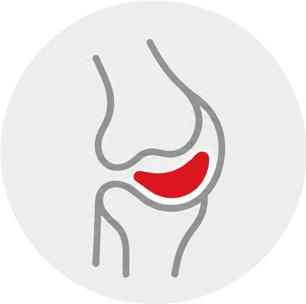 Meniscus Surgery