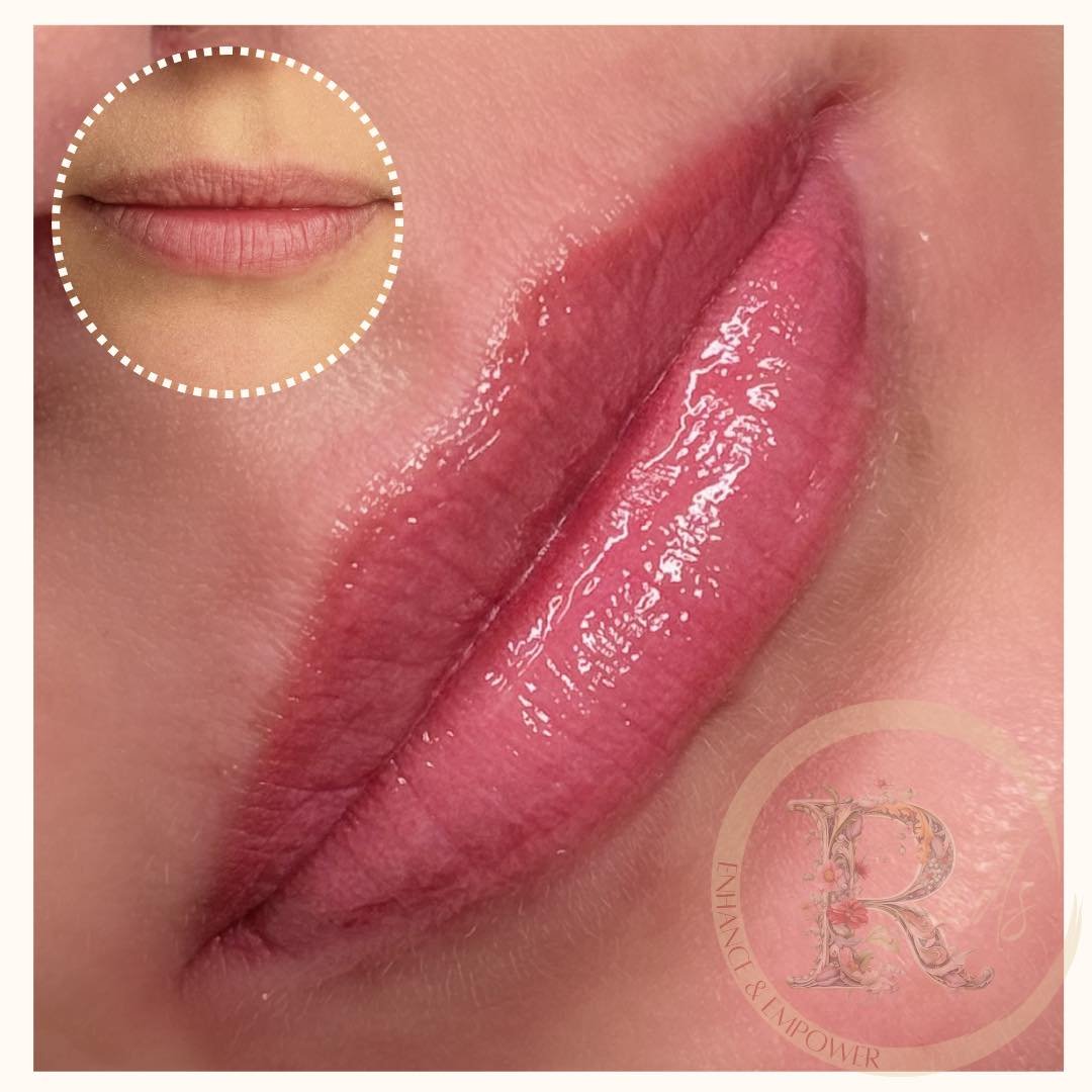 Swipe to see zoomed in areas of before 💕

Swipe back to hardly believe they&rsquo;re the same lip! 

Assignment was to achieve even pigmentation throughout, pick up post pigment from the borders and keep it natural and lighter due to skin tone ✨💕💋