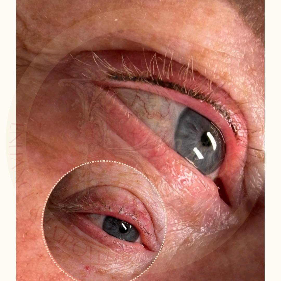 Need a bit of vavavoom for your eyes?

Look 👀 no further- 

✨ Lash liner enhancement is a subtle line in either brown or black pigment
🔥 You decide the top/bottom/ both and thickness - shape etc
🕰️ 45 minutes treatment time
😞 Pain - 0-1/10 as I n